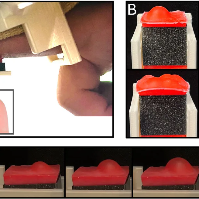 A Hybrid Soft Haptic Display for Rendering Lump Stiffness in Remote Palpation